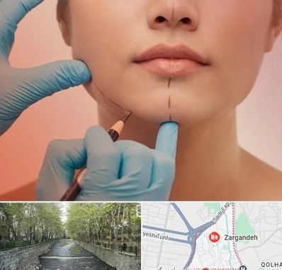 دکتر زیبایی خانم در زرگنده