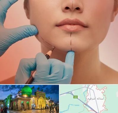 دکتر زیبایی خانم در آستانه اشرفیه