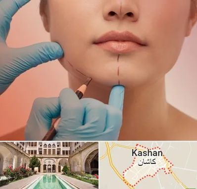 دکتر زیبایی خانم در کاشان