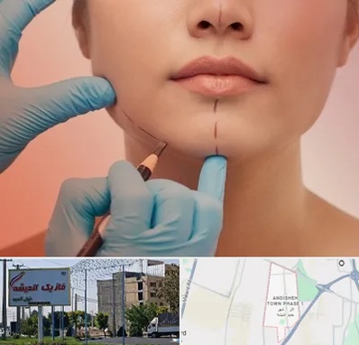 دکتر زیبایی خانم در فاز یک اندیشه
