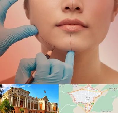 دکتر زیبایی خانم در خوی