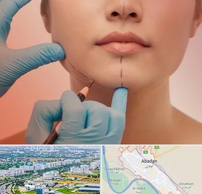 دکتر زیبایی خانم در آبادان