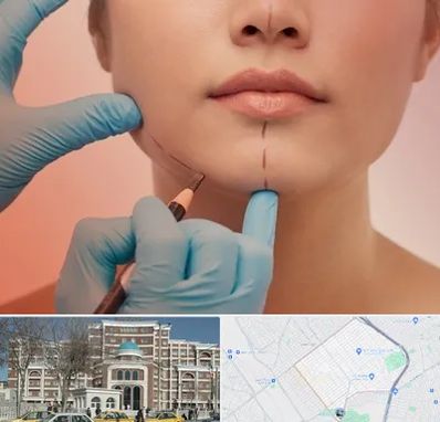 دکتر زیبایی خانم در طلاب مشهد