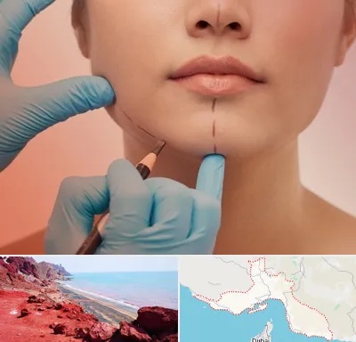 دکتر زیبایی خانم در هرمزگان