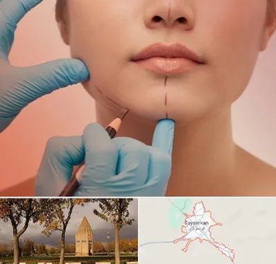 دکتر زیبایی خانم در تویسرکان