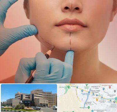 دکتر زیبایی خانم در صیاد شیرازی مشهد 