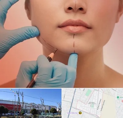 دکتر زیبایی خانم در فاز دو اندیشه