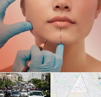 دکتر زیبایی خانم در سیدی مشهد