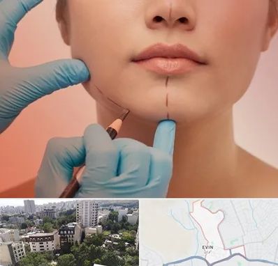 دکتر زیبایی خانم در اوین