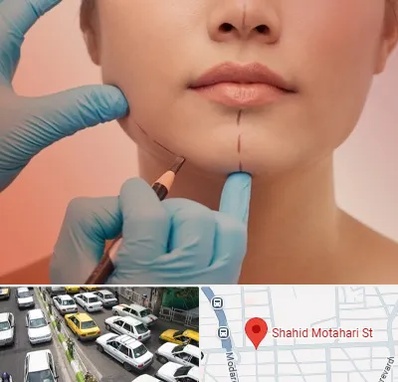 دکتر زیبایی خانم در مطهری تهران
