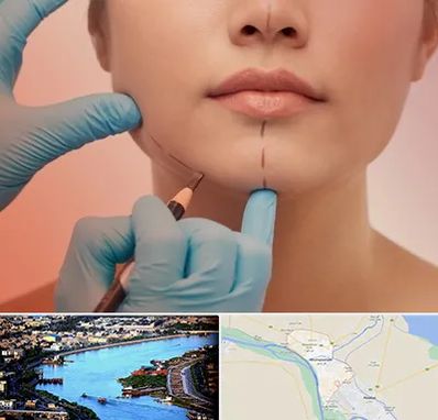 دکتر زیبایی خانم در خرمشهر