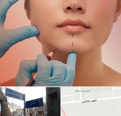دکتر زیبایی خانم در سی متری جی