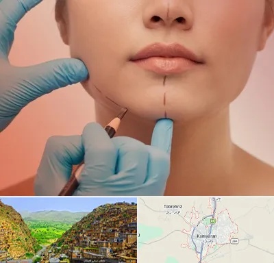 دکتر زیبایی خانم در کامیاران