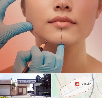 دکتر زیبایی خانم در وحیدیه شهریار