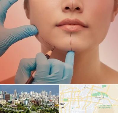 دکتر زیبایی خانم در شرق تهران 