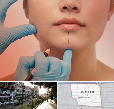 دکتر زیبایی خانم در خیابان جمالزاده