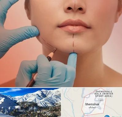 دکتر زیبایی خانم در شمشک