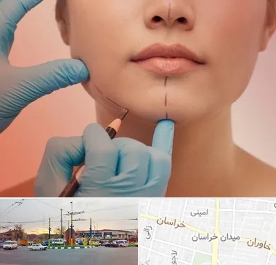 دکتر زیبایی خانم در میدان خراسان