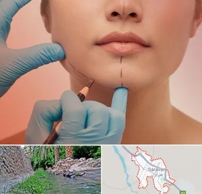 دکتر زیبایی خانم در سراوان