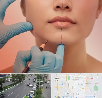 دکتر زیبایی خانم در ستارخان 