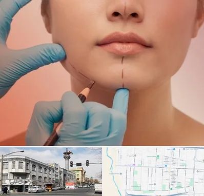 دکتر زیبایی خانم در 17شهریور