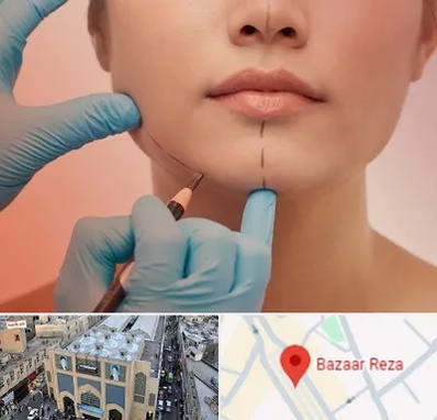 دکتر زیبایی خانم در بازار رضا مشهد