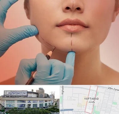 دکتر زیبایی خانم در یافت آباد