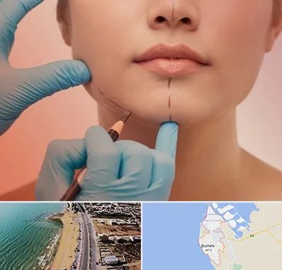 دکتر زیبایی خانم در بوشهر