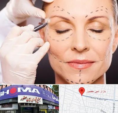 دکتر زیبایی صورت در امین حضور