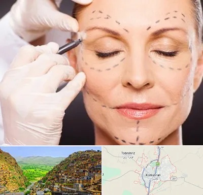 دکتر زیبایی صورت در کامیاران