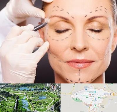 دکتر زیبایی صورت در بجنورد