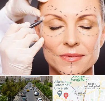 دکتر زیبایی صورت در شهران 