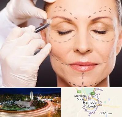 دکتر زیبایی صورت در همدان