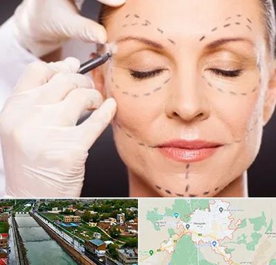 دکتر زیبایی صورت در مراغه