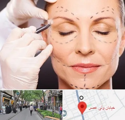 دکتر زیبایی صورت در ولیعصر شهریار