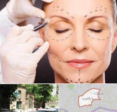 دکتر زیبایی صورت در دزاشیب