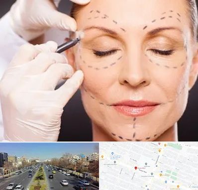 دکتر زیبایی صورت در بلوار معلم مشهد 