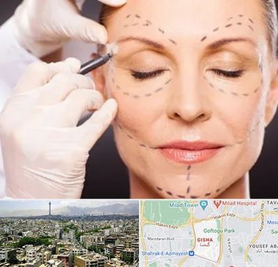 دکتر زیبایی صورت در گیشا 