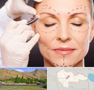 دکتر زیبایی صورت در خاش