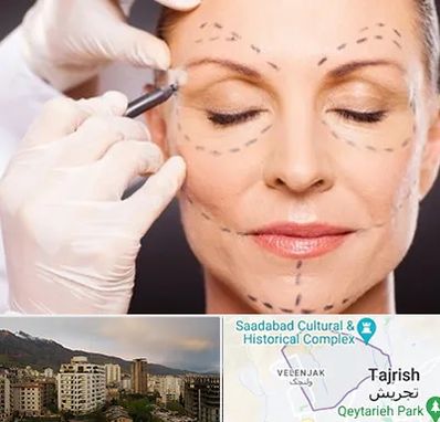 دکتر زیبایی صورت در زعفرانیه 