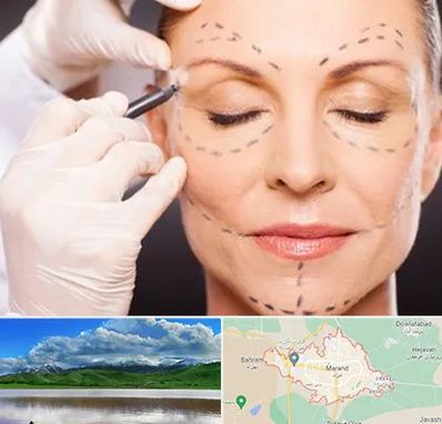 دکتر زیبایی صورت در مرند