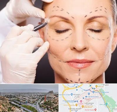 دکتر زیبایی صورت در معالی آباد شیراز 