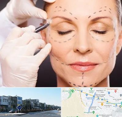 دکتر زیبایی صورت در شریعتی مشهد 