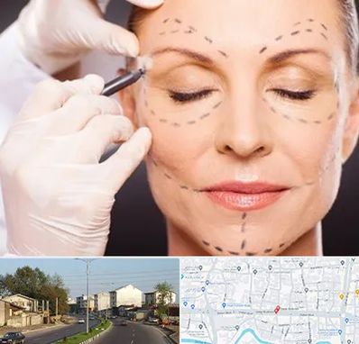 دکتر زیبایی صورت در ضیابری رشت 