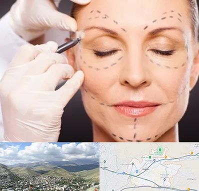 دکتر زیبایی صورت در رودهن