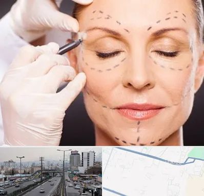 دکتر زیبایی صورت در بلوار ارتش