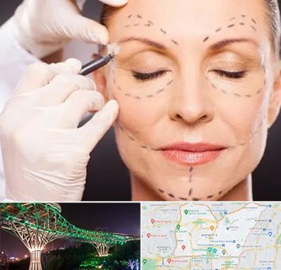 دکتر زیبایی صورت در منطقه 3 تهران 