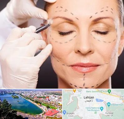 دکتر زیبایی صورت در لاهیجان