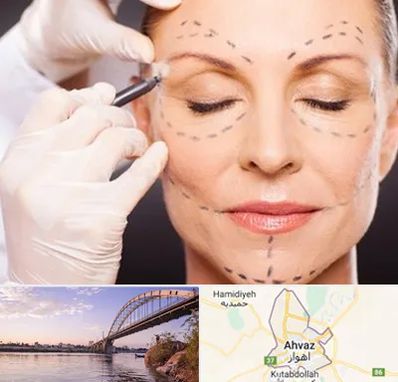 دکتر زیبایی صورت در اهواز