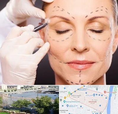 دکتر زیبایی صورت در گلستان اهواز 